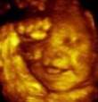 Bebelusii zambesc, plang, se freaca la
ochi, casca sau se intind inca din burta
mamei, incepand cam de la 18 - 26 de
saptamani de sarcina, potrivit
cercetatorilor britanici de la clinica
'Create ...